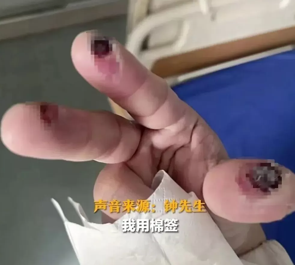 警惕清洁剂中隐藏的“化骨水”！你家可能也有-第1张图片-