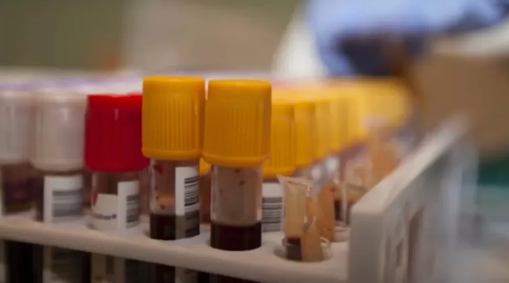 超一亿人处于危险之中，它被称为新的艾滋病-第5张图片-