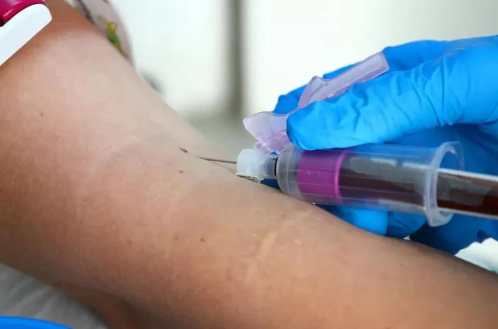 超一亿人处于危险之中，它被称为新的艾滋病-第4张图片-