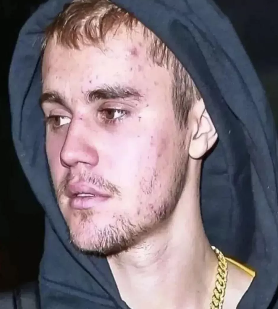 致命昆虫，专挑富人下手？-第6张图片-