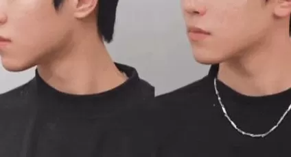 医美行业，坑了多少女大学生？-第11张图片-