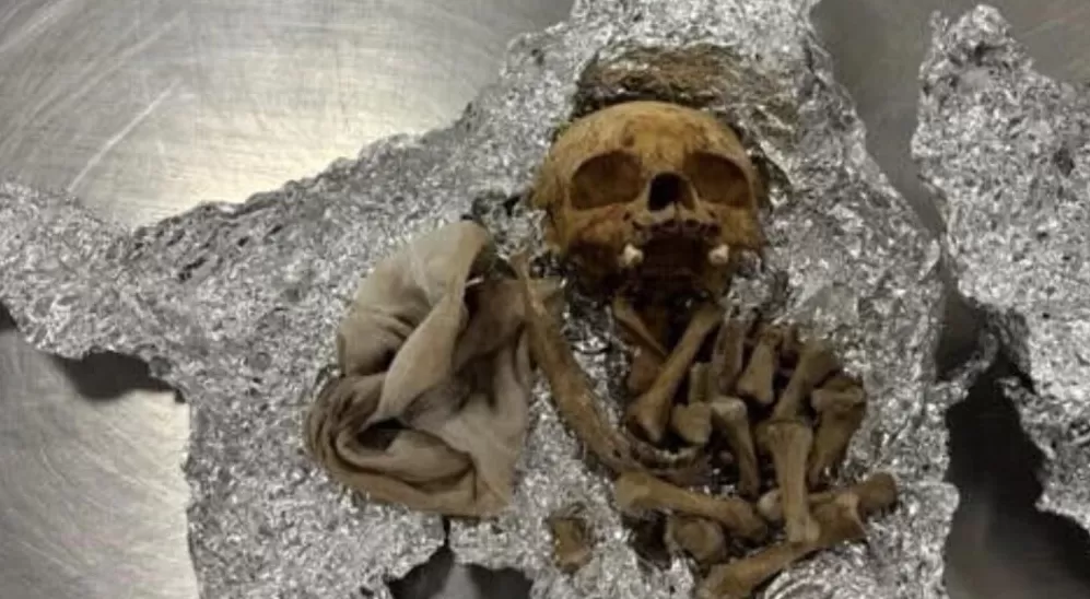 美国机场海关在一乘客行李中查获人类头骨，乘客：是用于举办仪式-第1张图片-