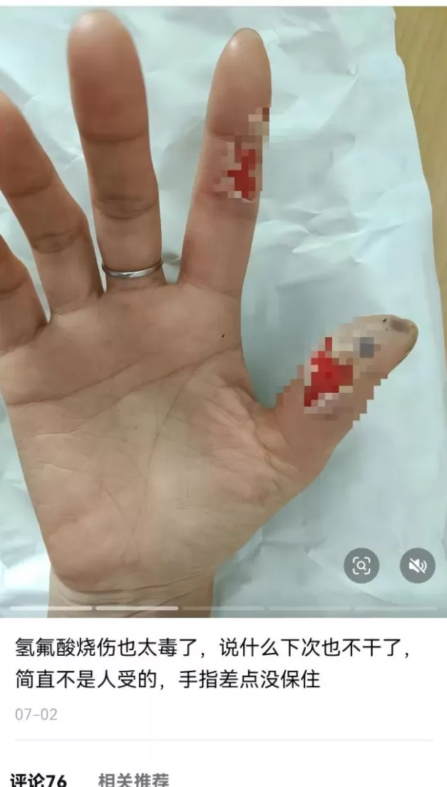 散步踩到氢氟酸去世,蛮离谱的-第10张图片- 散步踩到氢氟酸去世,蛮离谱的-第10张图片-