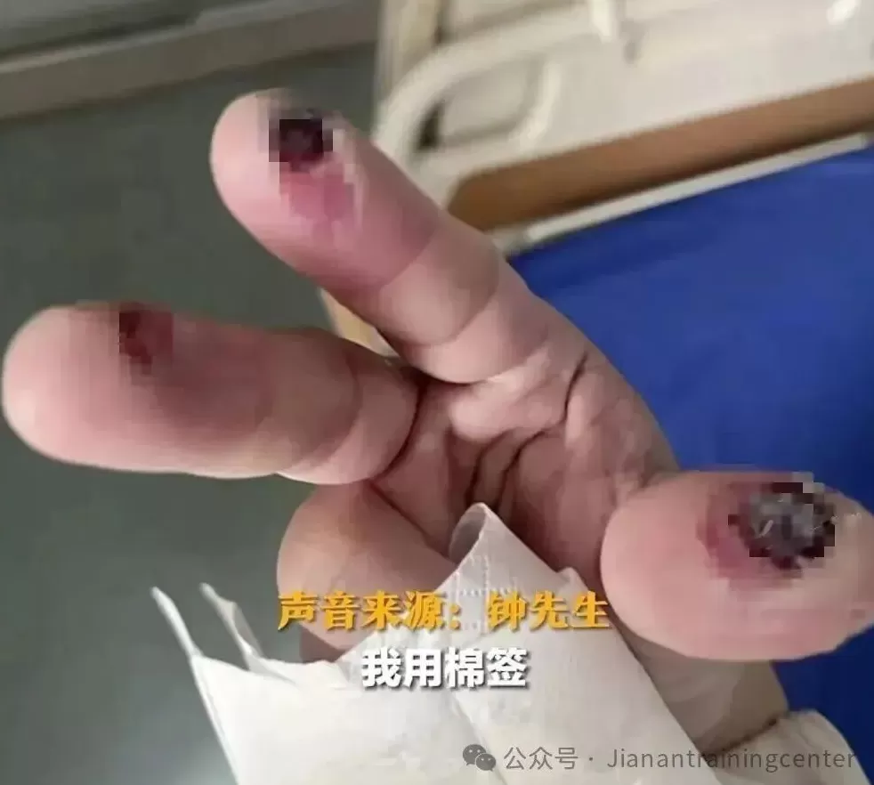 散步踩到氢氟酸去世,蛮离谱的-第8张图片- 散步踩到氢氟酸去世,蛮离谱的-第8张图片-