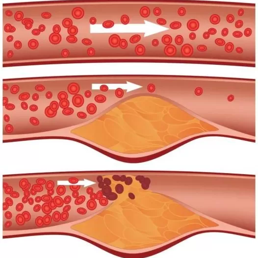 这种东西顿顿离不开，吃多了却容易一身病-第9张图片-