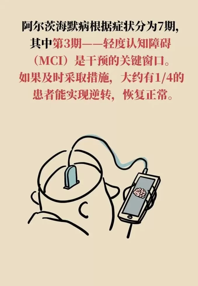 阿尔茨海默病可潜伏20年，抓住“黄金干预期”能逆转-第14张图片-