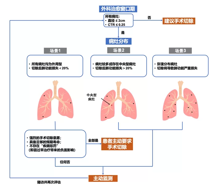 原发早期肺癌是否需要立刻手术？上海专家在权威期刊发表最新研究-第1张图片-