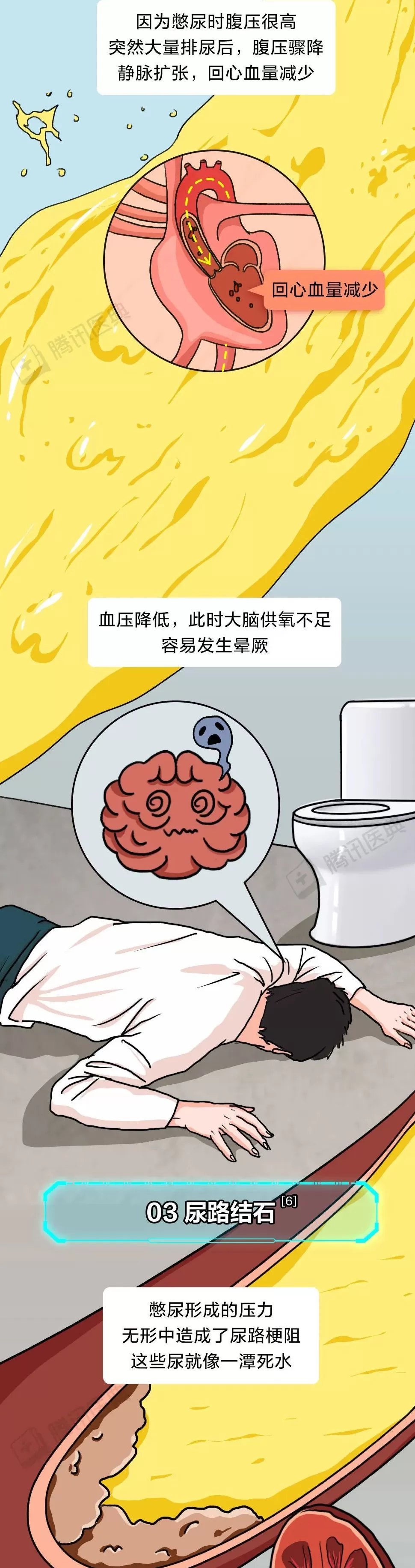膀胱最怕的这件事，你可能每天都在做-第10张图片-
