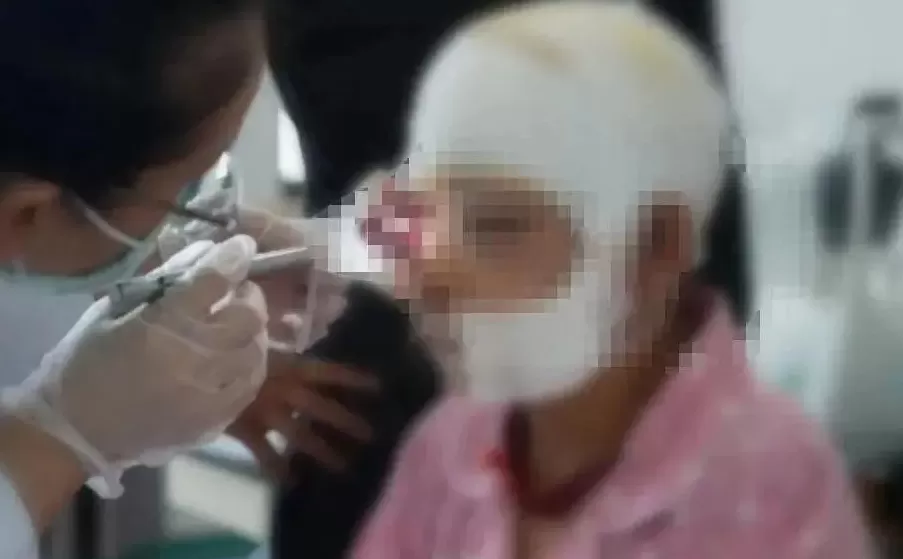 被熊袭击能装死吗？秋季“熊出没”如何避险-第1张图片-