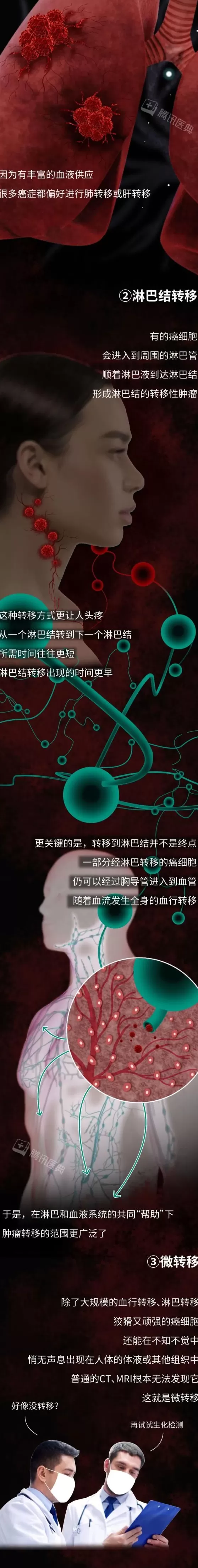 癌细胞，是怎样在身体里跑来跑去的？-第6张图片-