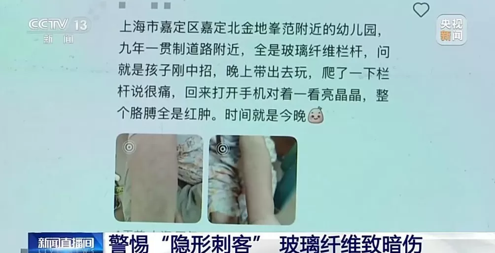 玻璃纤维扎进皮肤怎么办？别慌！正确处理步骤来了-第3张图片-