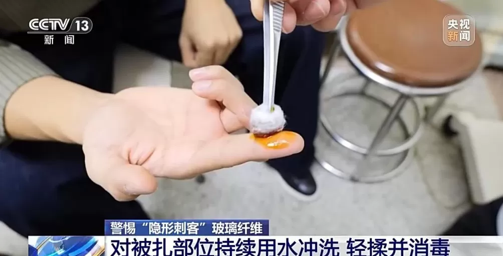 玻璃纤维扎进皮肤怎么办？别慌！正确处理步骤来了-第13张图片-