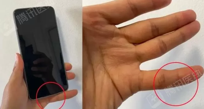 睡觉时手机千万别放床头，不是因为辐射致癌，而是……-第5张图片-