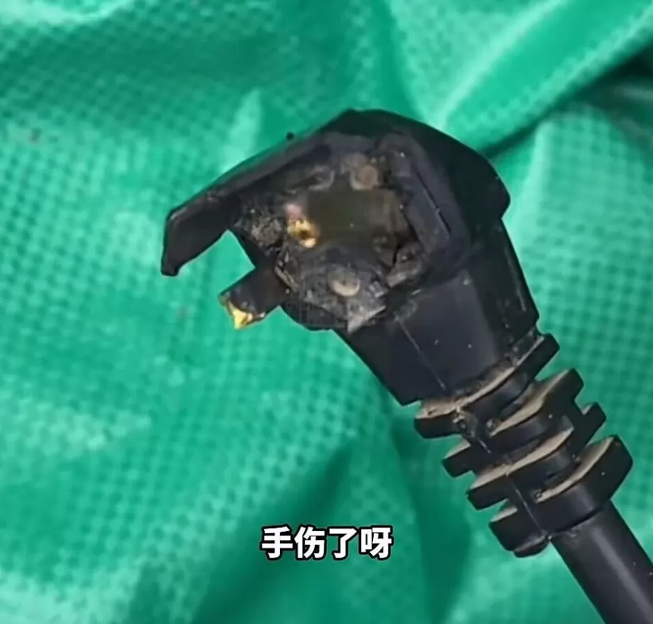 手被烧熟、金手镯被烧熔，女子给电动车充电，不慎碰到充电口受伤-第3张图片-