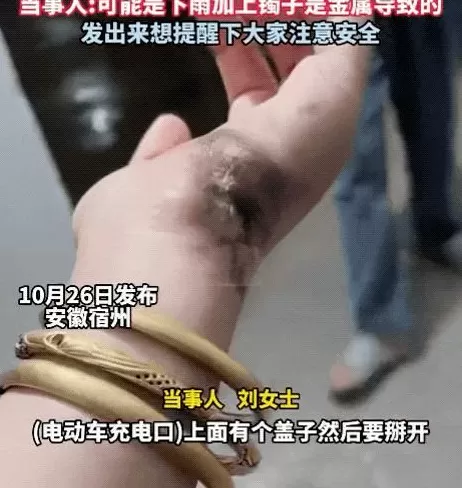 安徽一女子给电动自行车充电时不慎被电伤，手瞬间被烧黑，充电时应当注意这个细节-第1张图片-