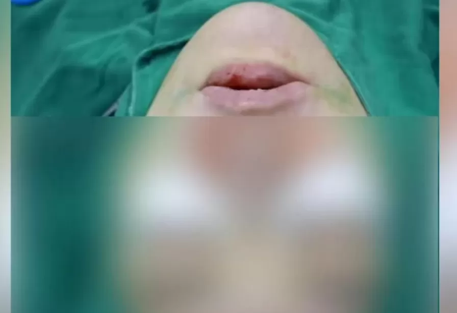 男子把钱交给女友保管,结果女友花了200多万在脸上!男友崩溃了-第3张图片- 男子把钱交给女友保管,结果女友花了200多万在脸上!男友崩溃了-第3张图片-