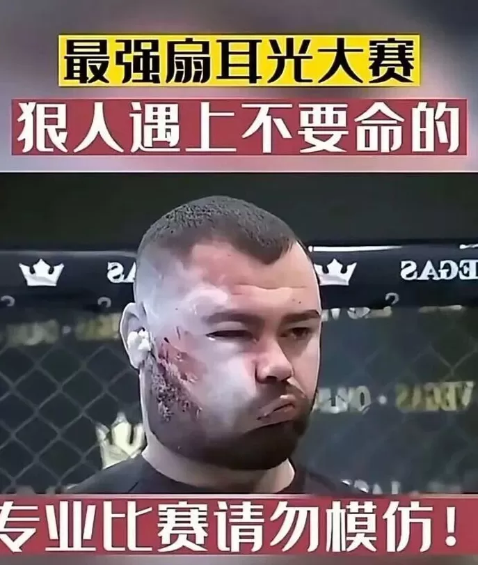 扇耳光大赛赵鸿刚输了,传统武术到底能不能打?-第7张图片- 扇耳光大赛赵鸿刚输了,传统武术到底能不能打?-第7张图片-