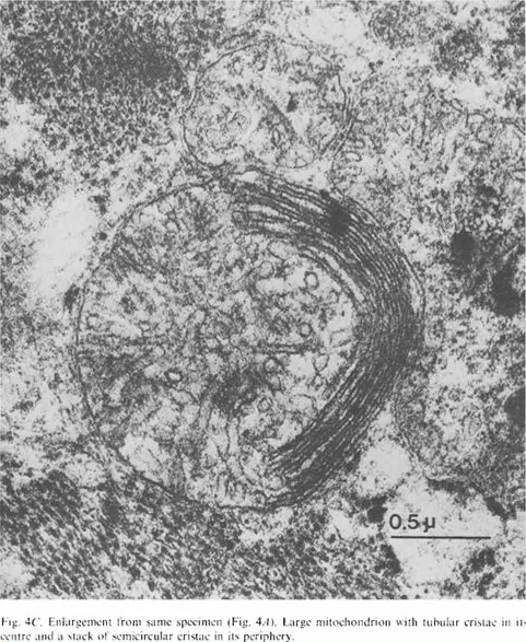 识病寻源|Barth综合征的疗法突破:罕见病需要被看见-第2张图片- 识病寻源|Barth综合征的疗法突破:罕见病需要被看见-第2张图片-