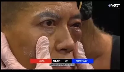 通背拳传人被几个耳光KO了,算不算传武的至暗时刻?-第5张图片- 通背拳传人被几个耳光KO了,算不算传武的至暗时刻?-第5张图片-