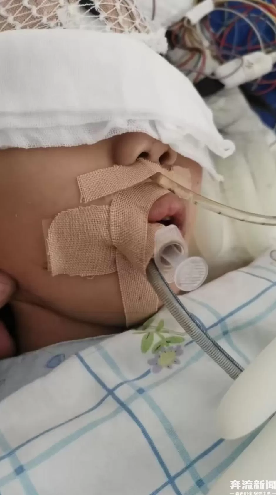 9岁女童术后成了植物人,河南省人民医院多科室医护人员篡改病历,被立案-第1张图片- 9岁女童术后成了植物人,河南省人民医院多科室医护人员篡改病历,被立案-第1张图片-