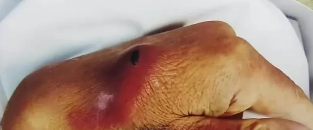 老人不“听话”就用剪刀扎？黑龙江一托老所因“虐老事件”被停业-第2张图片-