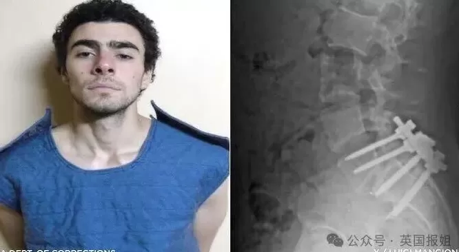 枪杀美医保CEO枪手曾被7个泰国人妖暴揍？狱中联络粉丝收28万，网友：这算啥英雄？-第6张图片-