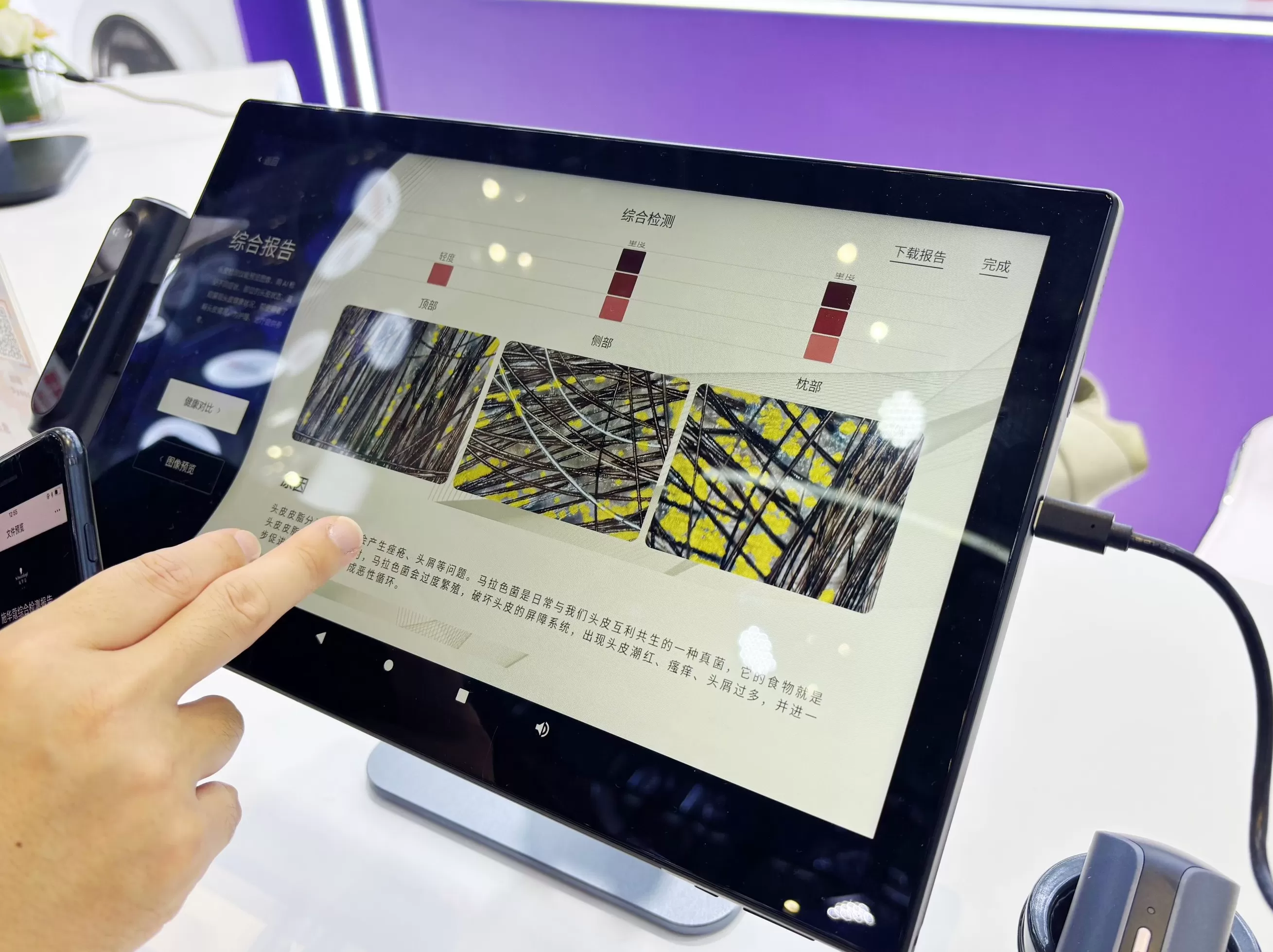 汉高消费品牌业务部大中华区副总裁钟经伟：于变局中布局，在升级中跃级-第4张图片-