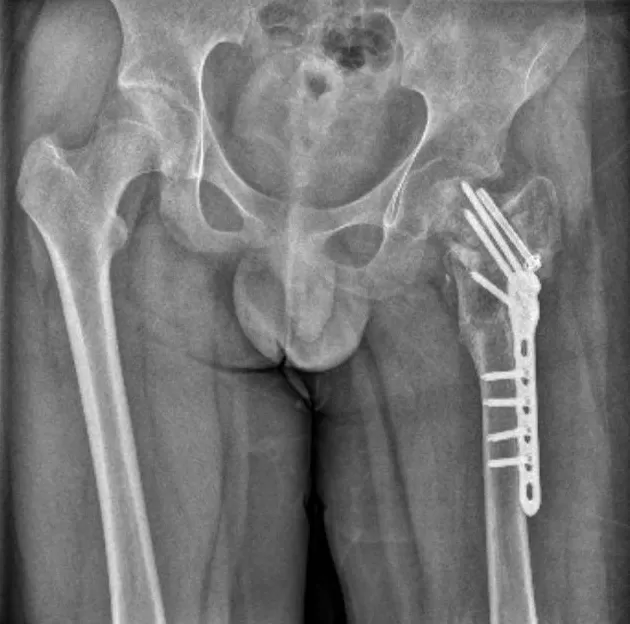 起底泉州“四维成长基地”：号称专治厌学、网瘾，动辄殴打关小黑屋-第3张图片-