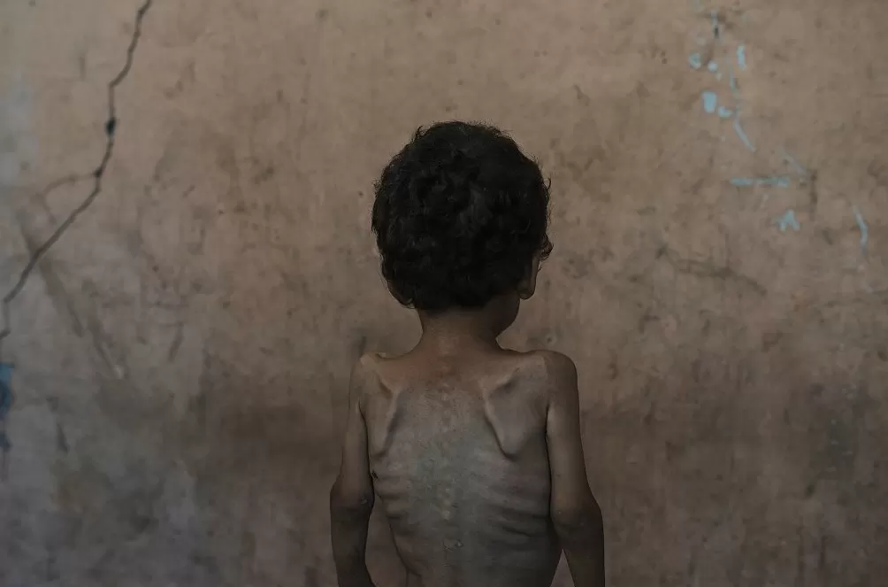 第1现场|迟到的疫苗:加沙启动接种,超4.4万儿童将受益-第9张图片- 第1现场|迟到的疫苗:加沙启动接种,超4.4万儿童将受益-第9张图片-