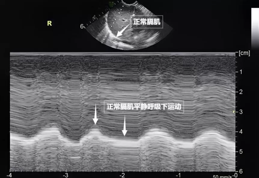 无声的声波有形的肺-第4张图片- 无声的声波有形的肺-第4张图片-