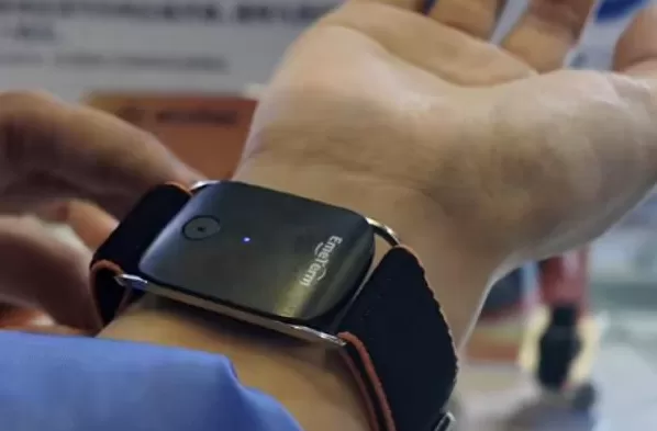 手环“电击续命”,有人已被烧伤-第2张图片- 手环“电击续命”,有人已被烧伤-第2张图片-