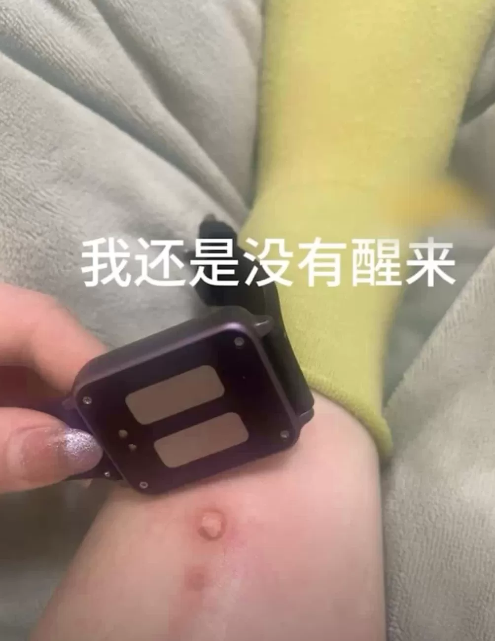 手环“电击续命”,有人已被烧伤-第6张图片- 手环“电击续命”,有人已被烧伤-第6张图片-