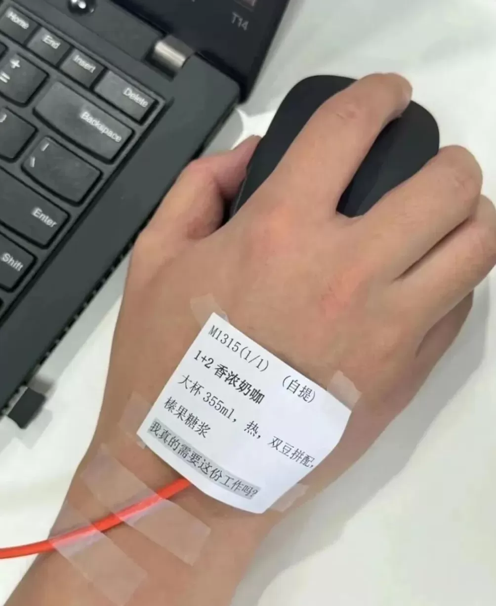 手环“电击续命”,有人已被烧伤-第7张图片- 手环“电击续命”,有人已被烧伤-第7张图片-