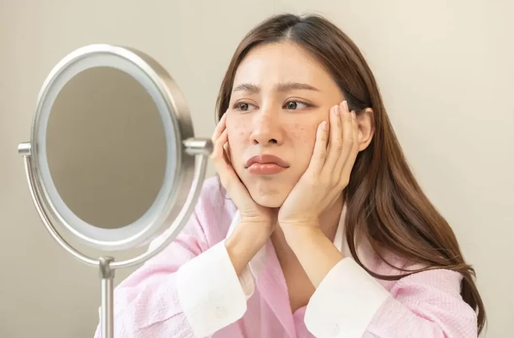 警报!你的脸蛋是否正在启动“秋冬崩盘”模式?-第2张图片- 警报!你的脸蛋是否正在启动“秋冬崩盘”模式?-第2张图片-