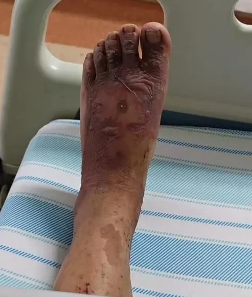 野蛮生长的荒野求生:有人提前找荒山“实习”,有人烫伤数日未被发现-第3张图片- 野蛮生长的荒野求生:有人提前找荒山“实习”,有人烫伤数日未被发现-第3张图片-