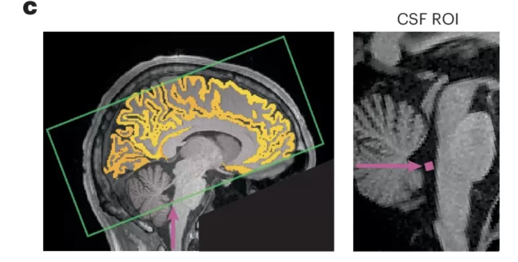 最新研究：熬大夜，又多了这些不可逆的代价-第6张图片-