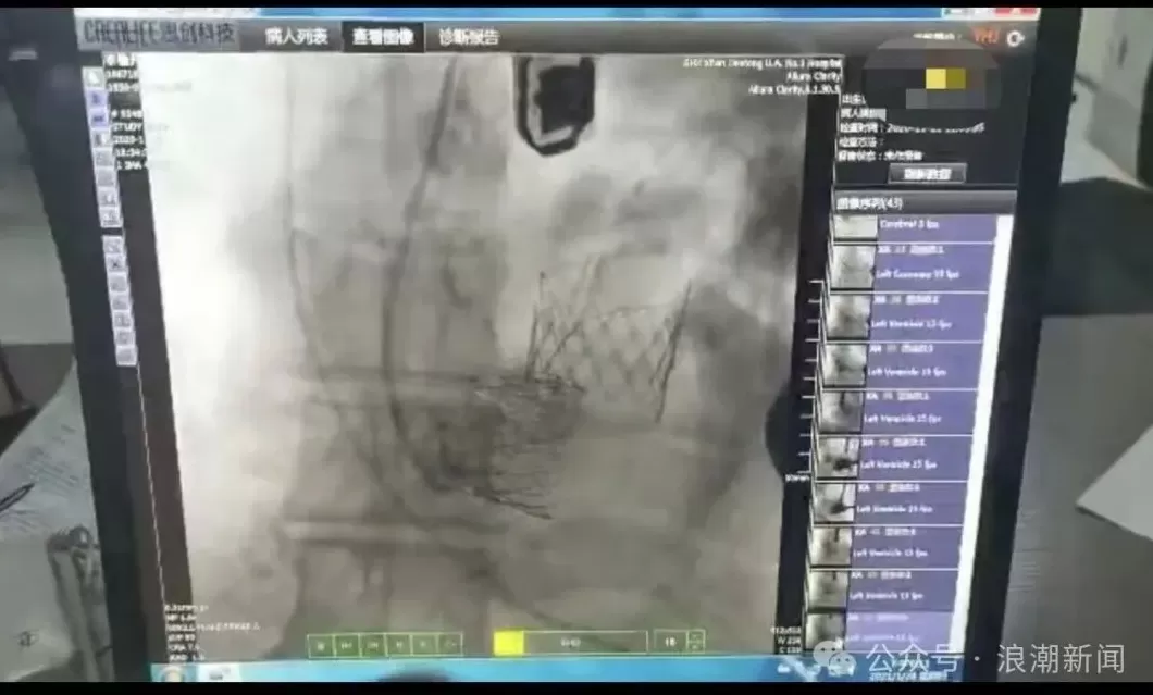 西安交大一附院再曝“瓣膜谜团”:出厂价3万多,医院收28万-第2张图片- 西安交大一附院再曝“瓣膜谜团”:出厂价3万多,医院收28万-第2张图片-