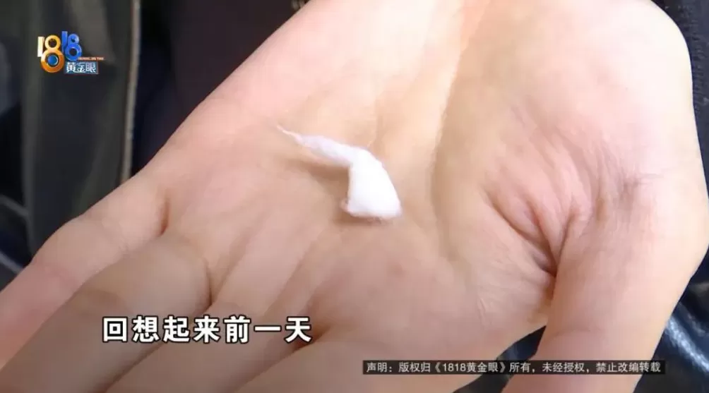 理完发第三天，女子从耳朵里掏出一团棉花-第6张图片-